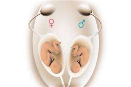 体外受精 IVF-ET